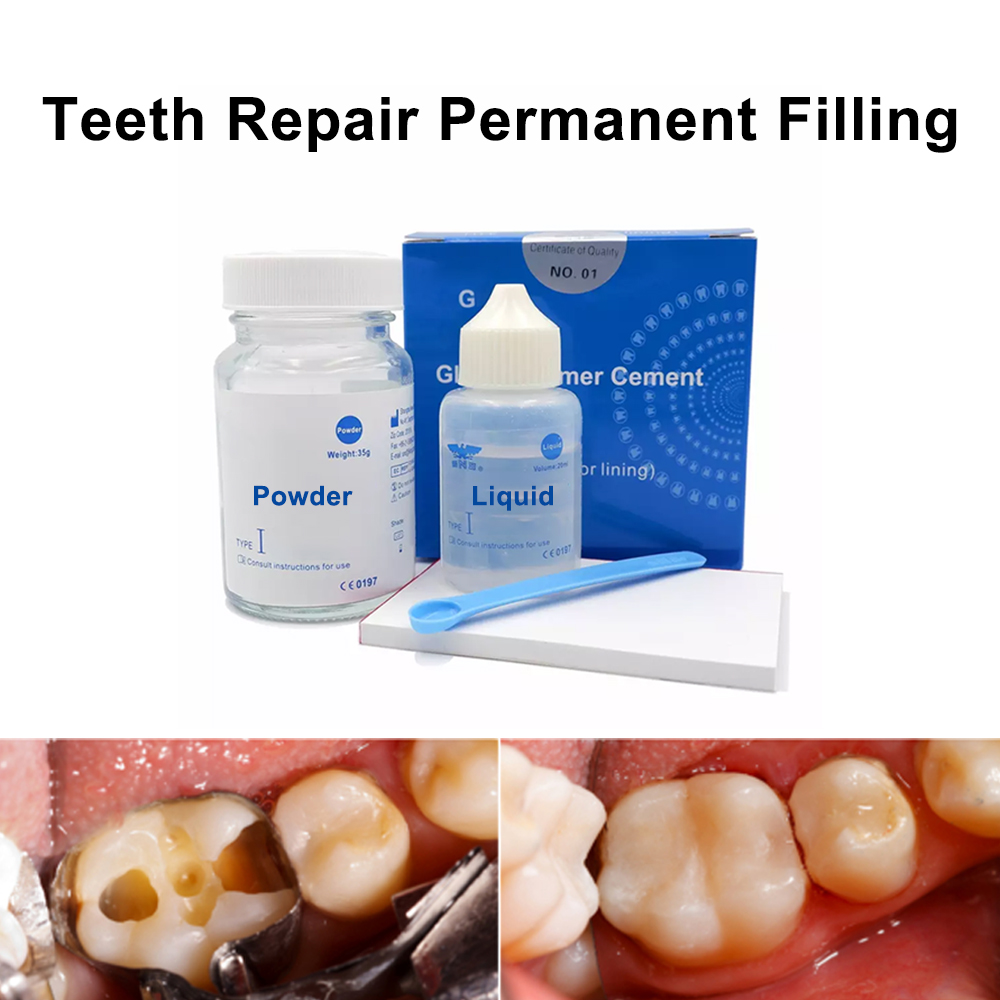 Teeth Whitening At Home Kit - Kit Perbaikan Tambal Gigi Permanen Di