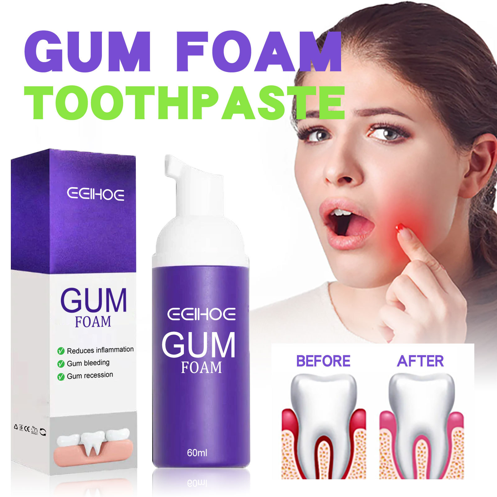 Teeth Whitening Crest - 60Ml Mousse Pemutih Gigi V34 Pasta