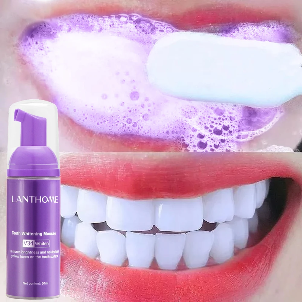 Teeth Whitening Crest - Mousse pasta gigi V34 pembersih gigi