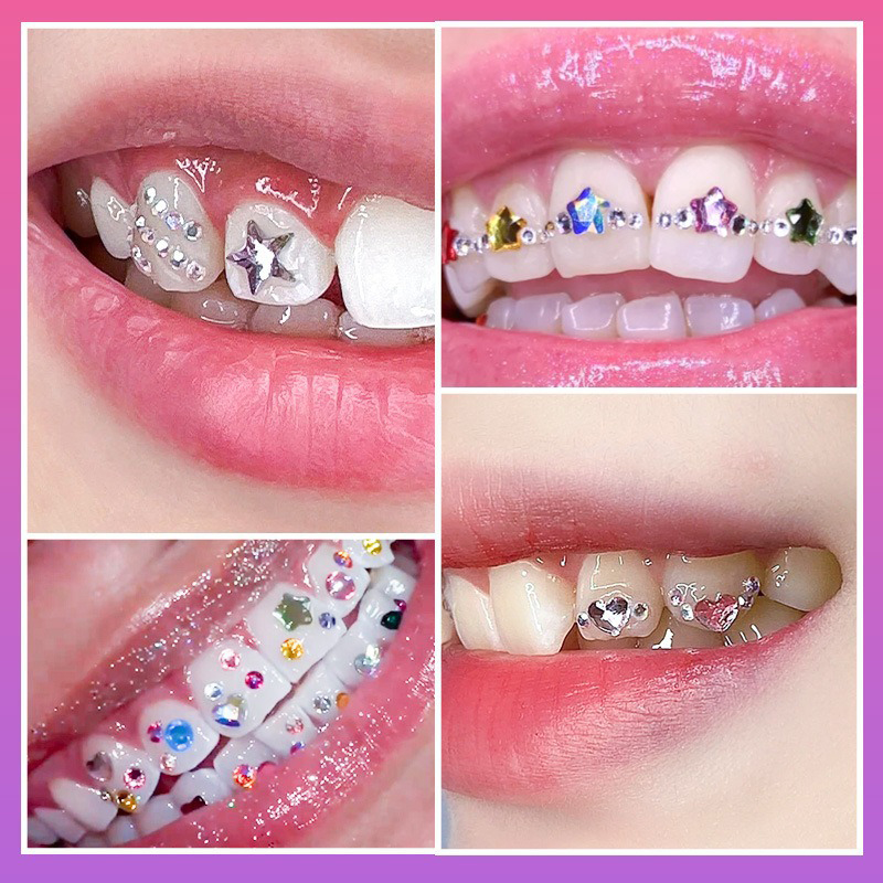Kit Perhiasan Gigi Profesional - Tooth Gem Kit ulasan dan harga