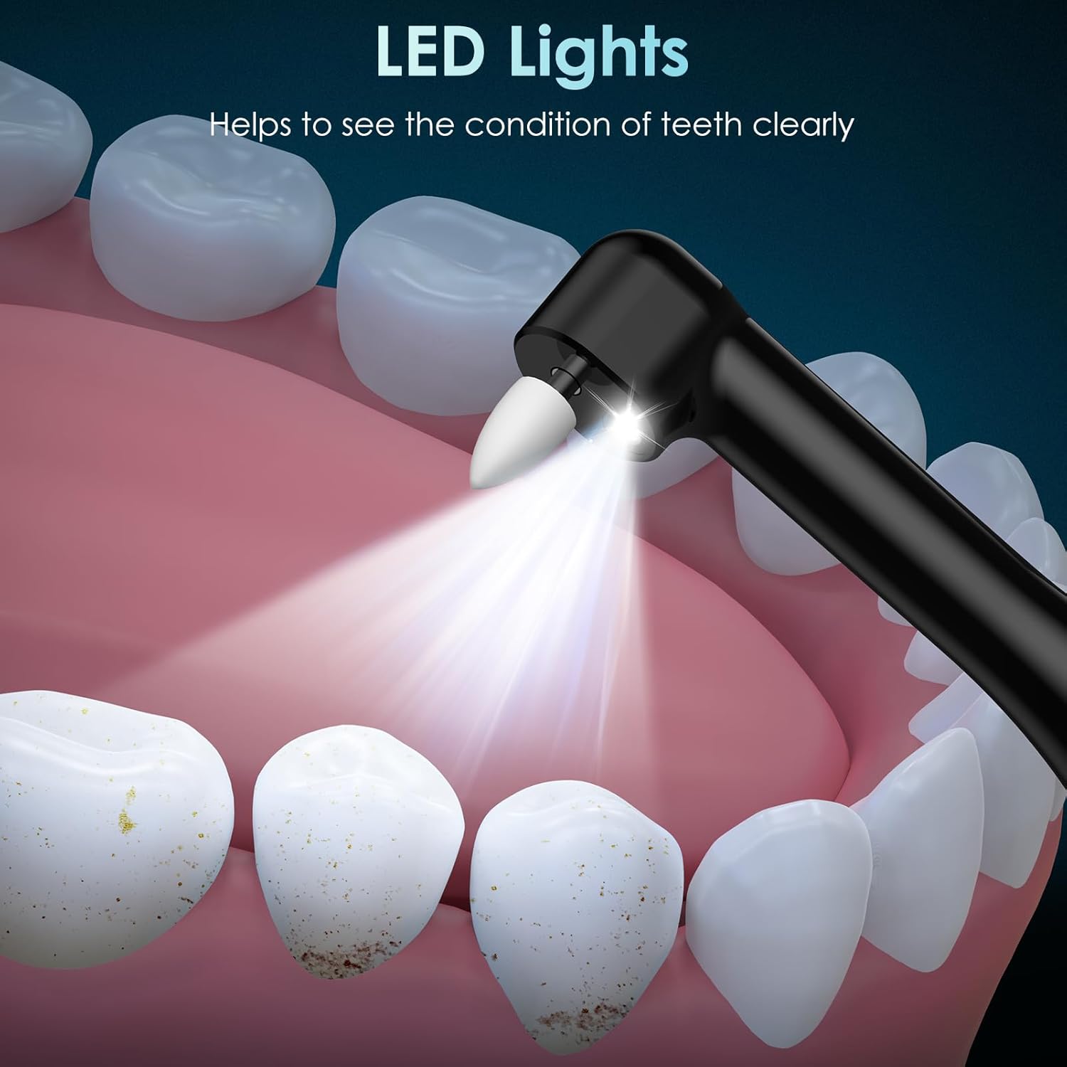 Pemoles Gigi Pemoles Gigi Isi  - Teeth Whitening Or Tooth Whitening ulasan dan harga