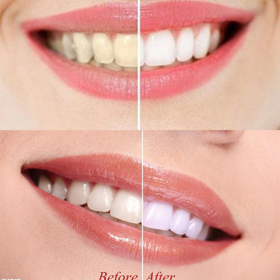 Arang Bambu Gigi Gigi Gigi Gig - Teeth Whitening Powder ulasan dan harga