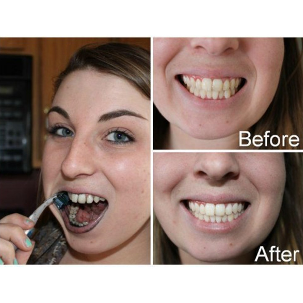 Arang Bambu Gigi Gigi Gigi Gig - Teeth Whitening Powder ulasan dan harga