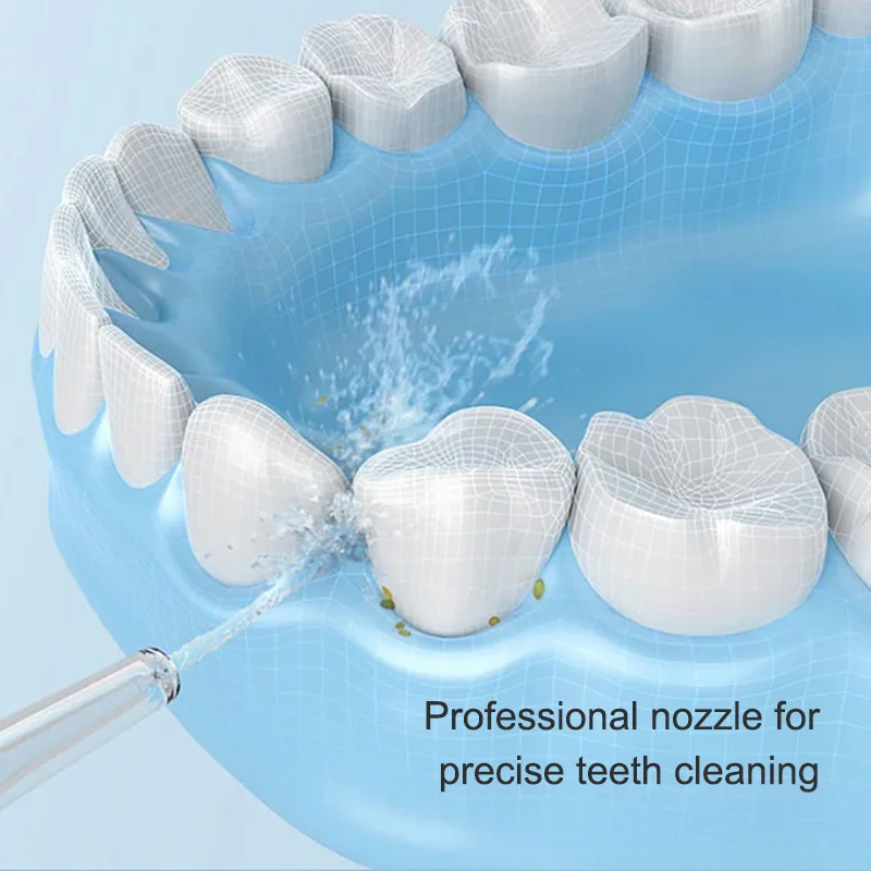 Mijia MEO701 Irigator Oral Por - Teeth Whitening Or Tooth Whitening ulasan dan harga
