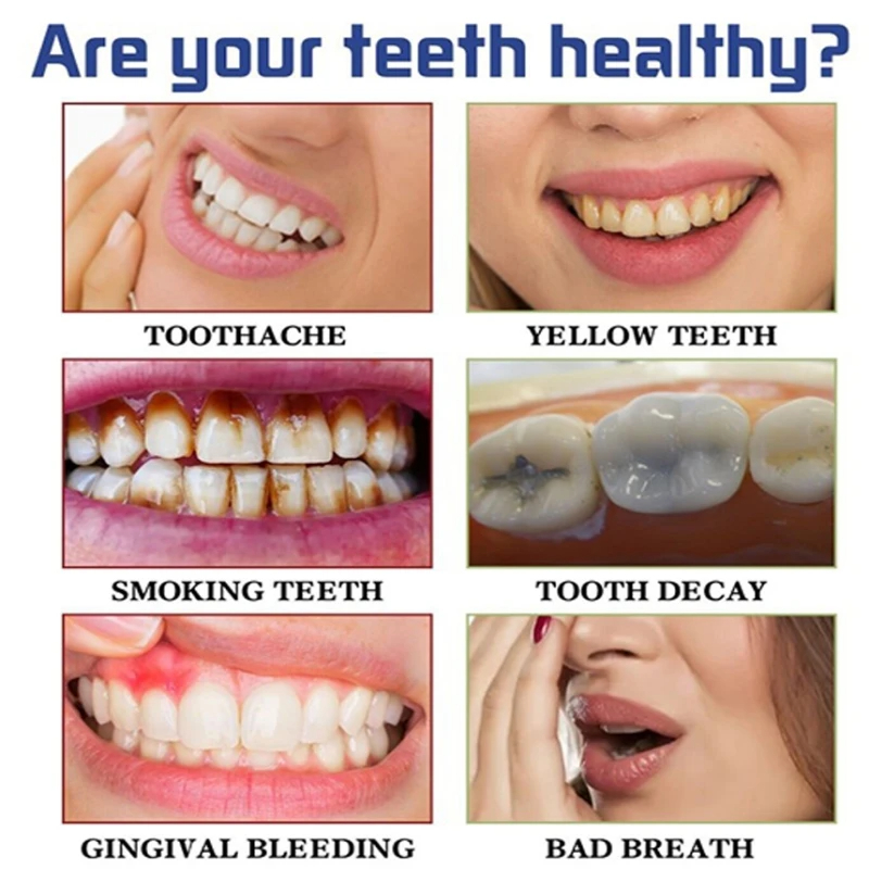 V34 Pro perbaikan plak penghil - Teeth Whitening Crest ulasan dan harga