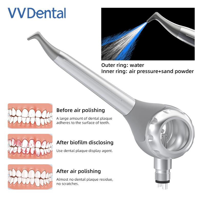 VV Dental 2/4 Lubang Pistol Pe - Teeth Whitening Dental ulasan dan harga