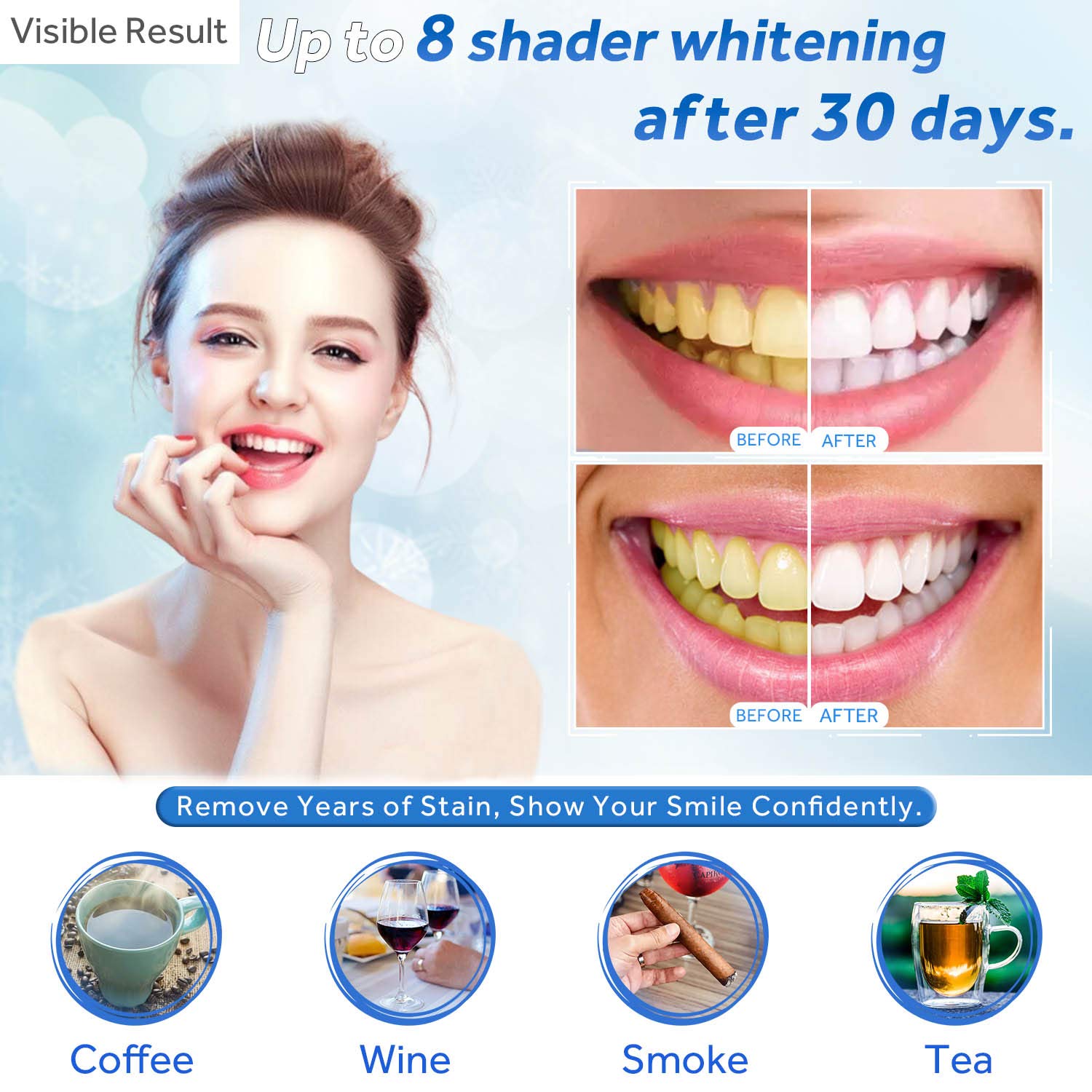 Gel Pemutih Gigi Isi Ulang Syr - Teeth Whitening Price ulasan dan harga