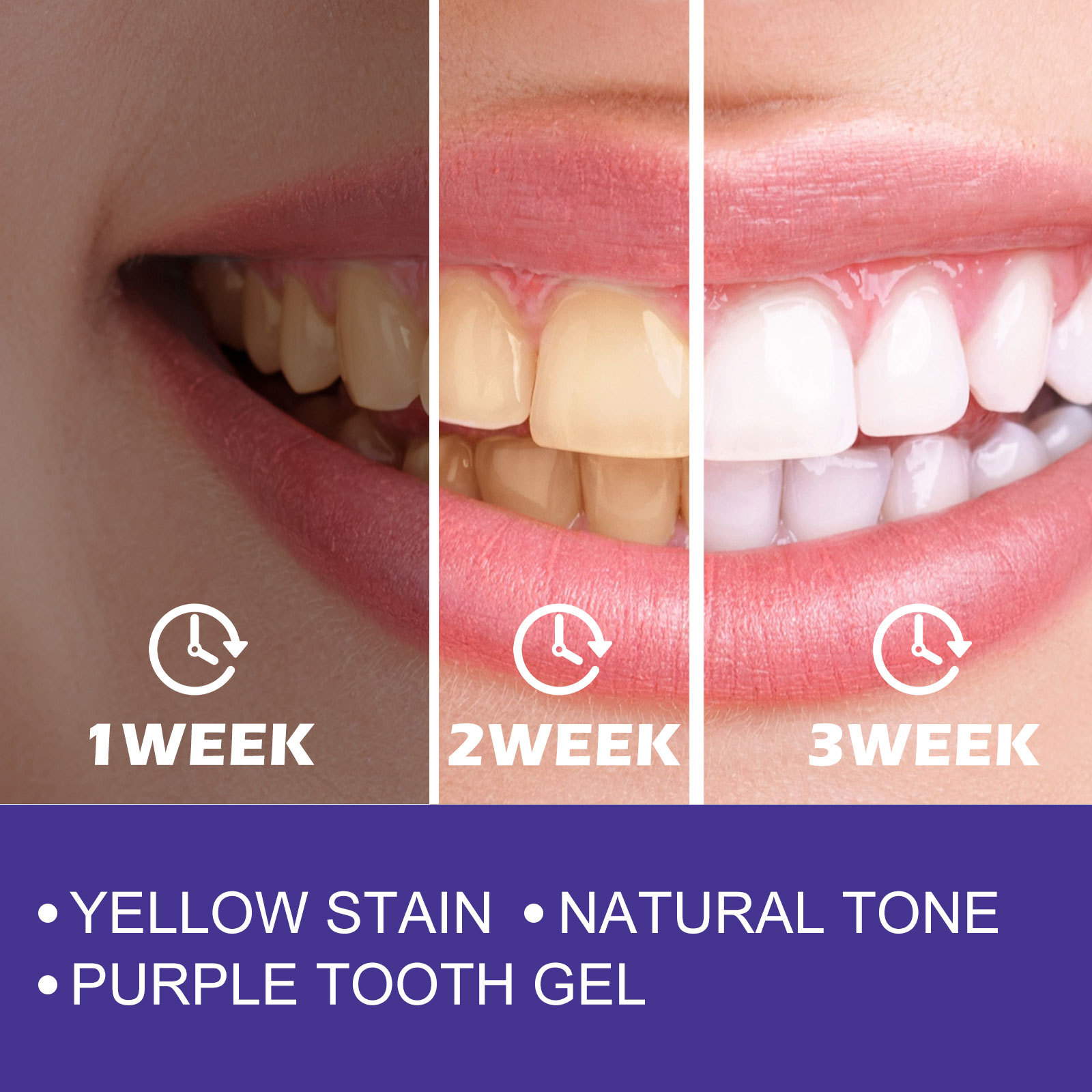 Pasta Gigi Ungu Pemutih Gigi M - Teeth Whitening Crest ulasan dan harga