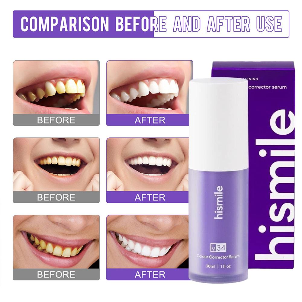    Serum Pemutih Gigi Hismile - Teeth Whitening Crest ulasan dan harga