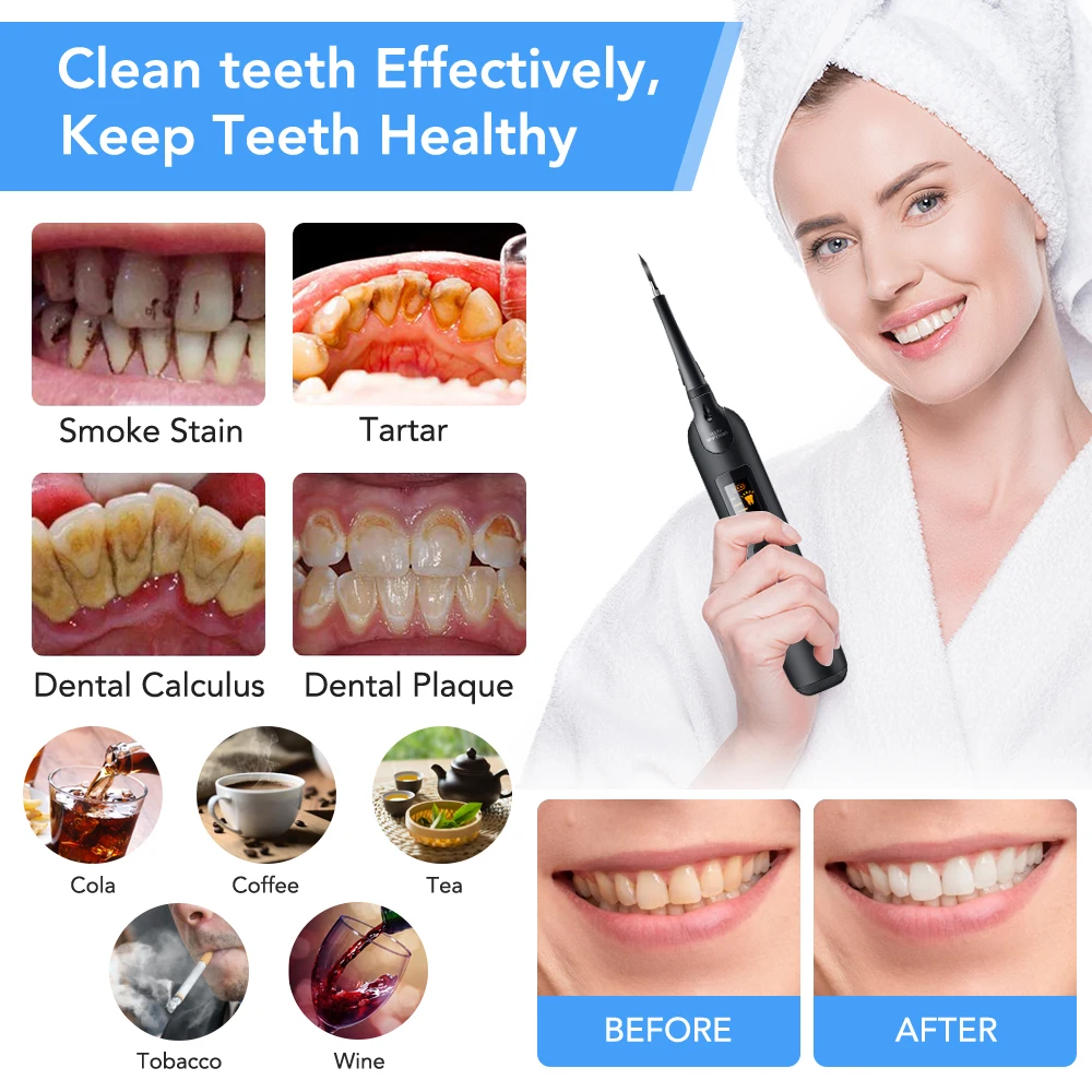Set Sikat Gigi Scaler Gigi Ele - Teeth Whitening Or Tooth Whitening ulasan dan harga