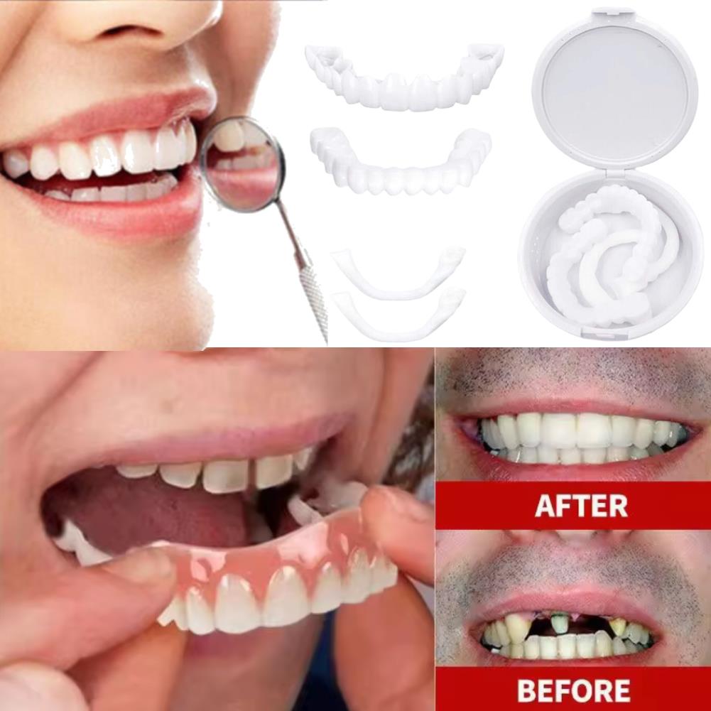 Veneer Gigi Senyum Menawan Bar - Teeth Whitening Uneven ulasan dan harga