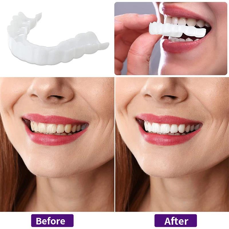Veneer Gigi Perbaikan Cacat Ba - Teeth Whitening Uneven ulasan dan harga