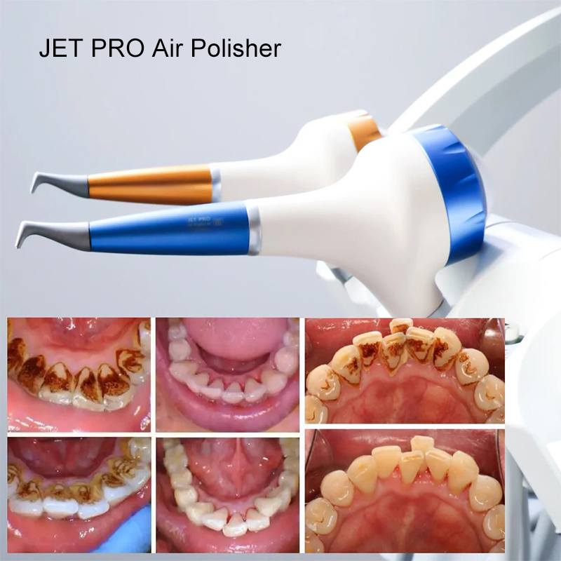 VV Dental Air Polishing Prophy - Teeth Whitening Dental ulasan dan harga