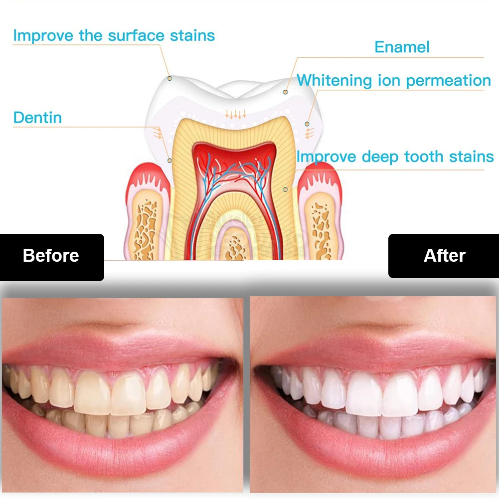 Kit pemutih gigi Mini 16 LED c - Teeth Whitening With Blue Light ulasan dan harga