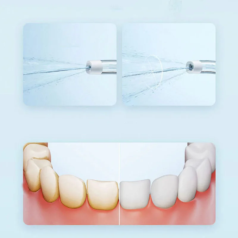 Xiaomi Irigator Mulut Portabel - Teeth Whitening Or Tooth Whitening ulasan dan harga