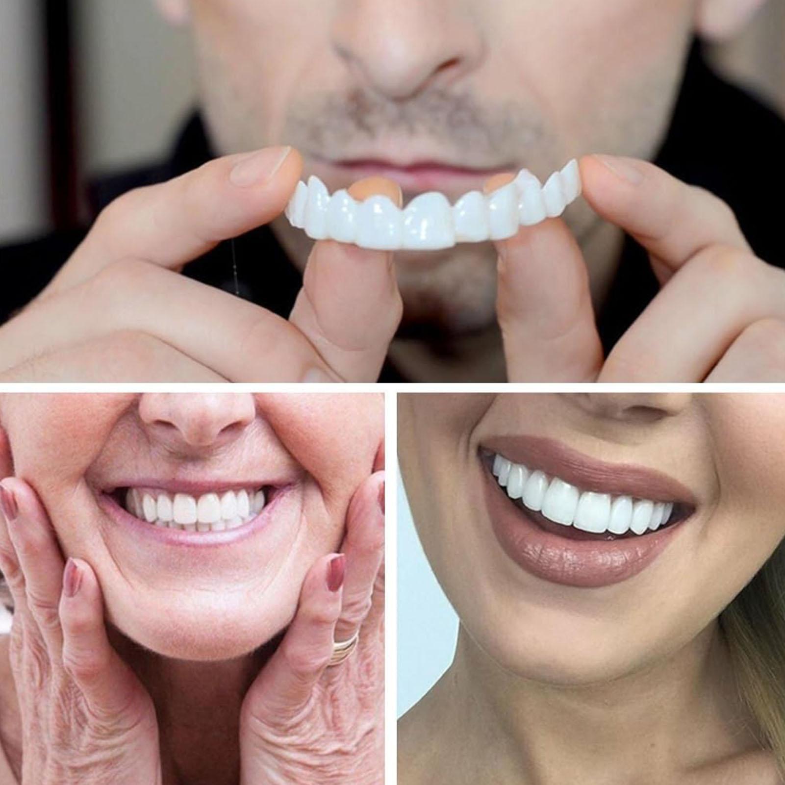 Veneer Gigi Perbaikan Cacat Ba - Teeth Whitening Uneven ulasan dan harga