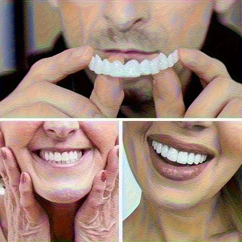 Veneer Gigi Baru untuk Memperb - Teeth Whitening Uneven ulasan dan harga