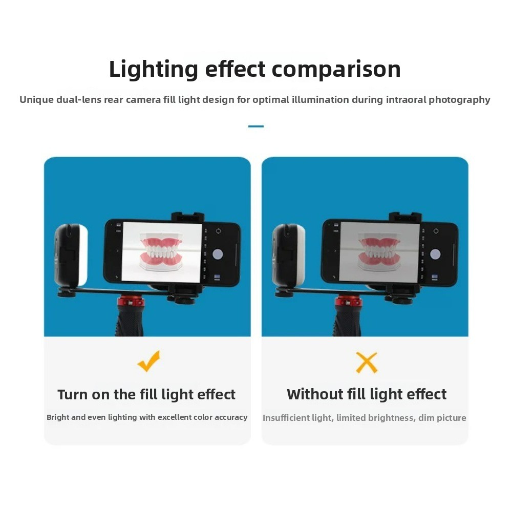 Lampu Fotografi Gigi, Flash LE - Teeth Whitening Kit ulasan dan harga