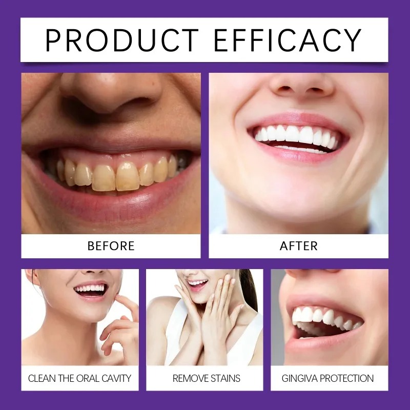 Bubuk Mineral Restorasi Gigi U - Teeth Whitening Quotes ulasan dan harga