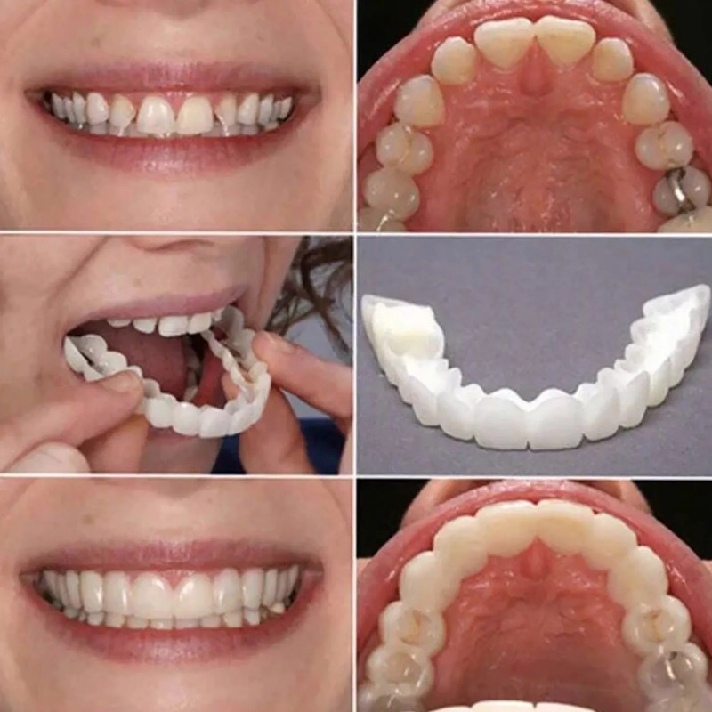 Veneer Gigi Palsu Sementara ya - Teeth Whitening Uneven ulasan dan harga