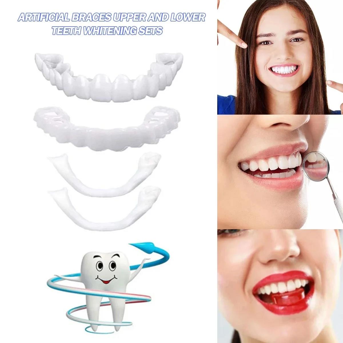 Veneer Gigi Palsu Sementara ya - Teeth Whitening Uneven ulasan dan harga